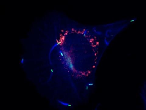 photo of Listeria infecting a cell