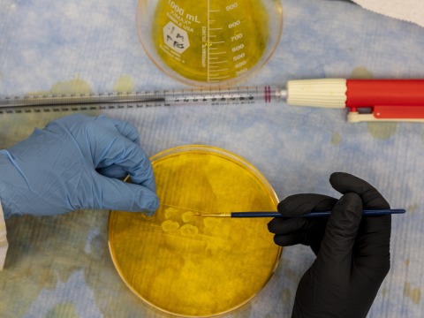 Gloved hands place samples of brain tissue in a petri dish filled with yellow solution.